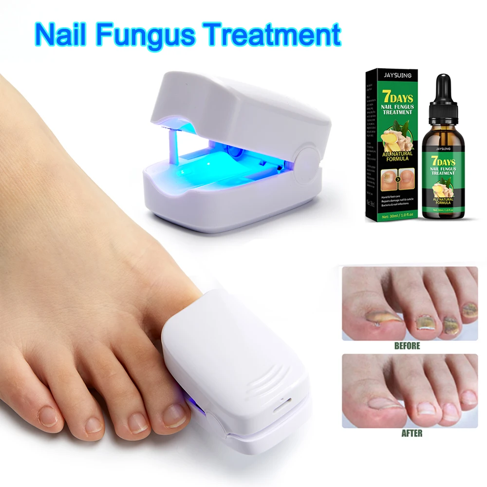 Ongle Pedicure