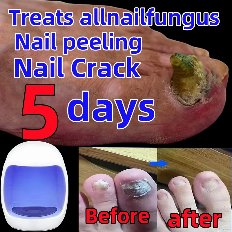 Ongle Pedicure